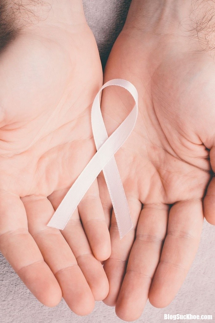 2 breast cancer myths 142142169 Nguyên nhân ung thư vú không chỉ là di truyền, đây là những điều cần biết